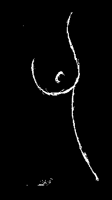 breast