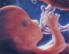 Human foetus
