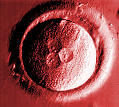 Human zygote6